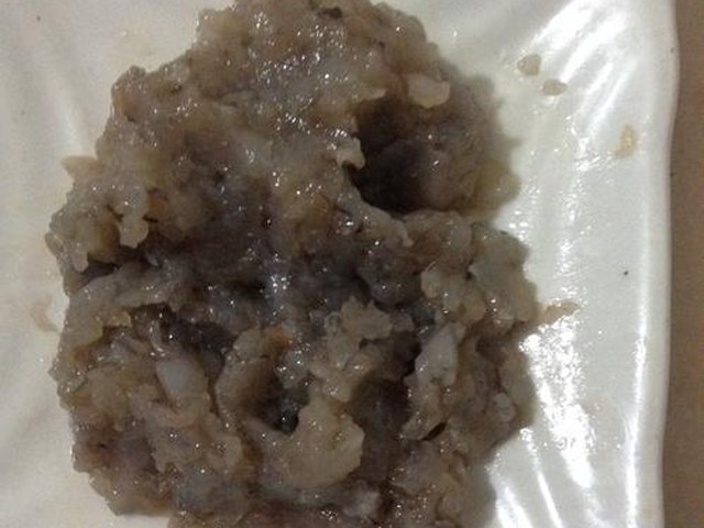 【鲜虾土豆丸】步骤3