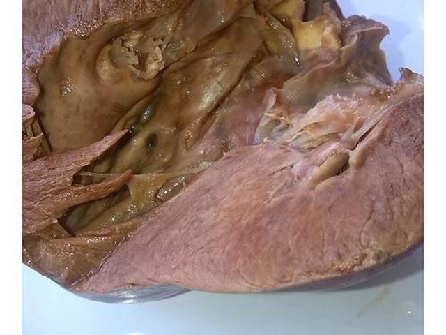 【凉拌猪心肉】步骤3